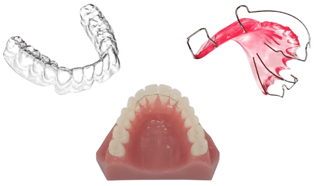 이바른치과교정과치과_교정유지장치수리